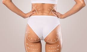 Why choose Turkey for a Brazilian Butt Lift - illustrative image